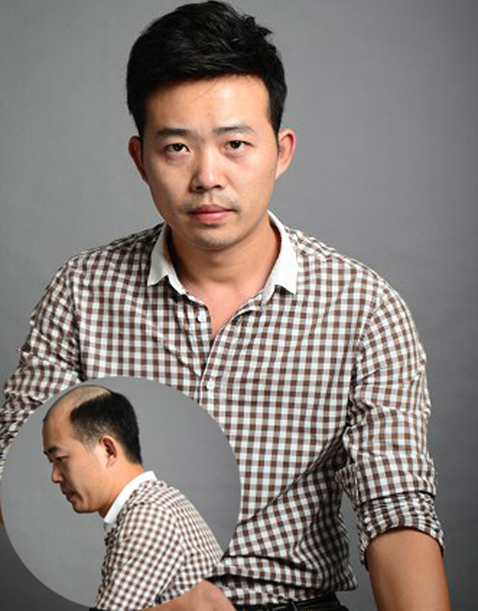 Những mẫu tóc giả dành cho nam giới đẹp nhất tại Tóc giả Sài Gòn