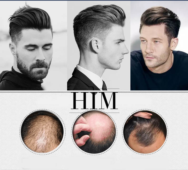 Top 5 mẫu tóc giả siêu da đầu nam Undercut được yêu thích nhất