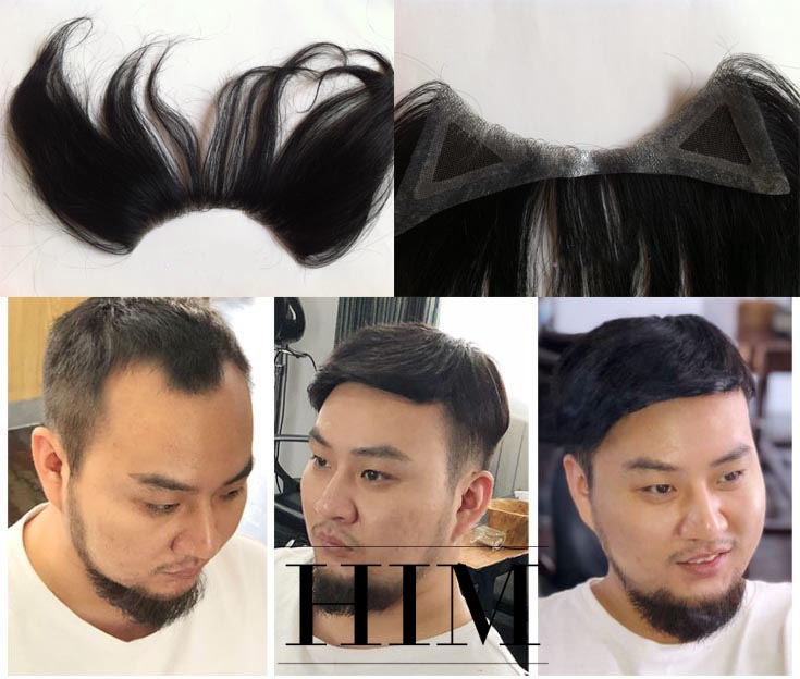 Top 6 Thương hiệu tóc giả cho nam giới uy tín nhất tại Việt Nam  toplistvn